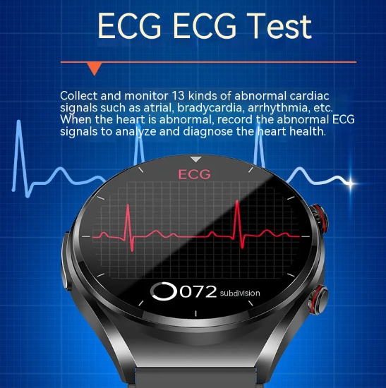 Smartwatch